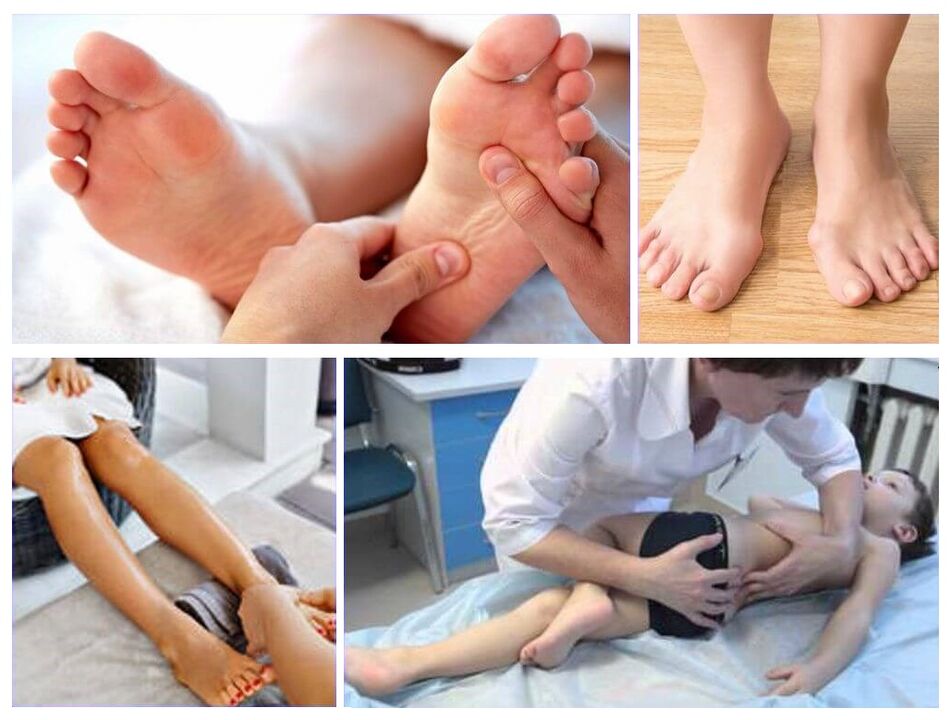 Haurren tratamenduan Valgus deformazioa