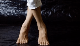 Valgus deformazioa